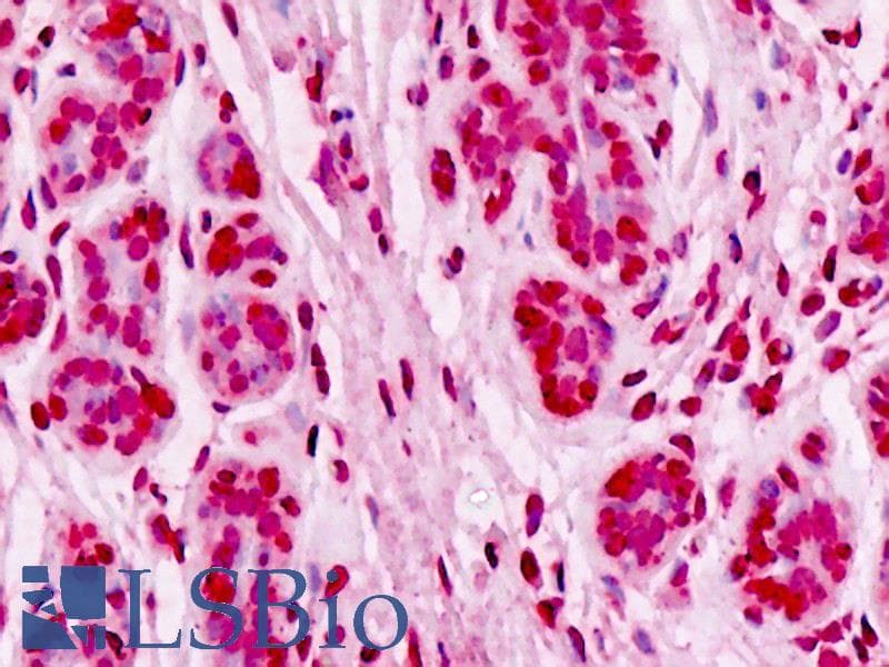 IHC-plus™ UBE2D1 / UBCH5 Antibody (clone 2C6)
