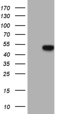 GC / Vitamin D-Binding Protein Antibody (clone OTI2A1)