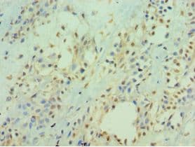 ICAM2 / CD102 Antibody (aa25-223)