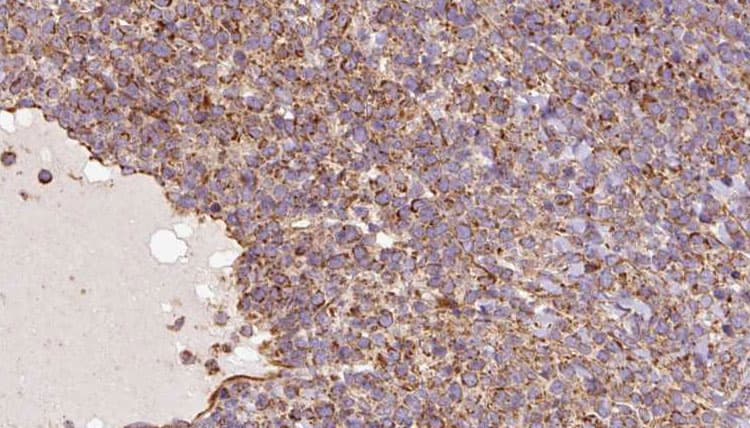 Polyclonal Rabbit anti-Human UQCRC1 Antibody (IHC, IF, WB)