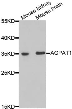 Polyclonal Rabbit anti-Human AGPAT1 Antibody (IHC, WB)
