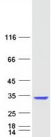 Human PHOSPHO1 Protein (Recombinant Myc-DDK (Flag))