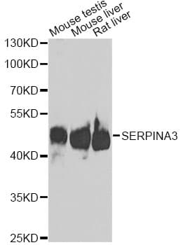 Alpha-1-Antichymotrypsin Antibody