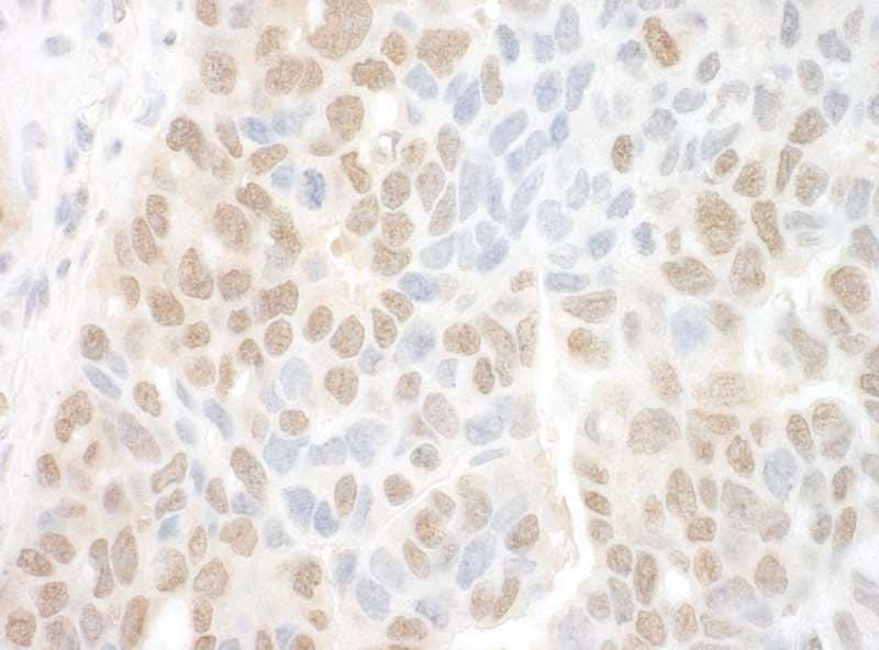 FAN1 Antibody (aa1-50)