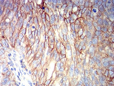 ALCAM / CD166 Antibody (clone 2F1B12)