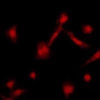 ADRBK1 / GRK2 Antibody (C-Terminus)