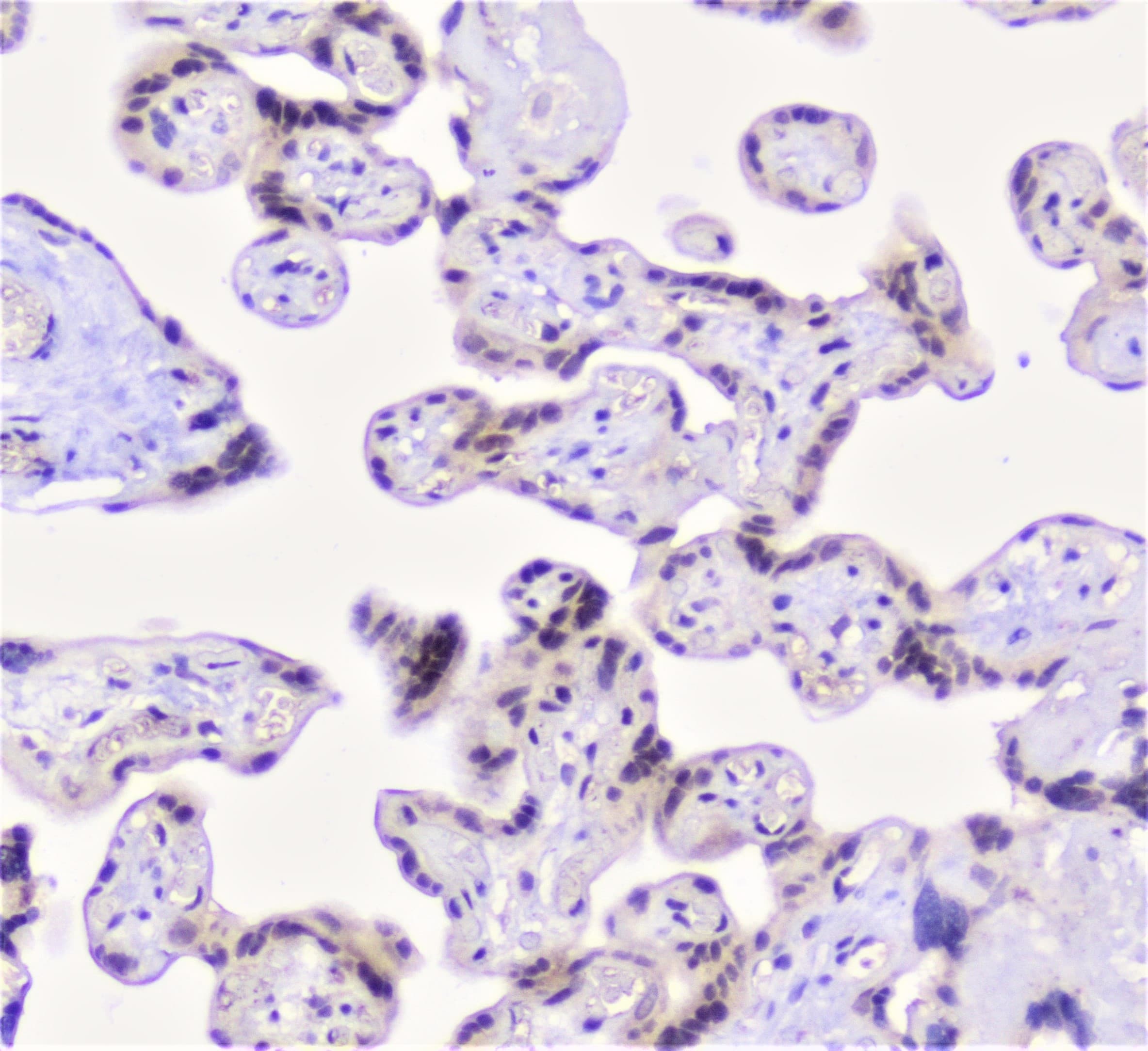 Properdin / CFP Antibody