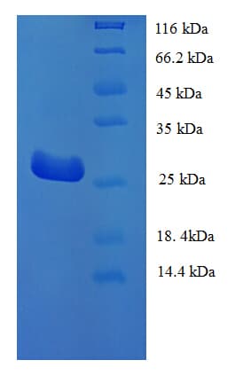 Human TP1 / TEP1 Protein (Recombinant His)