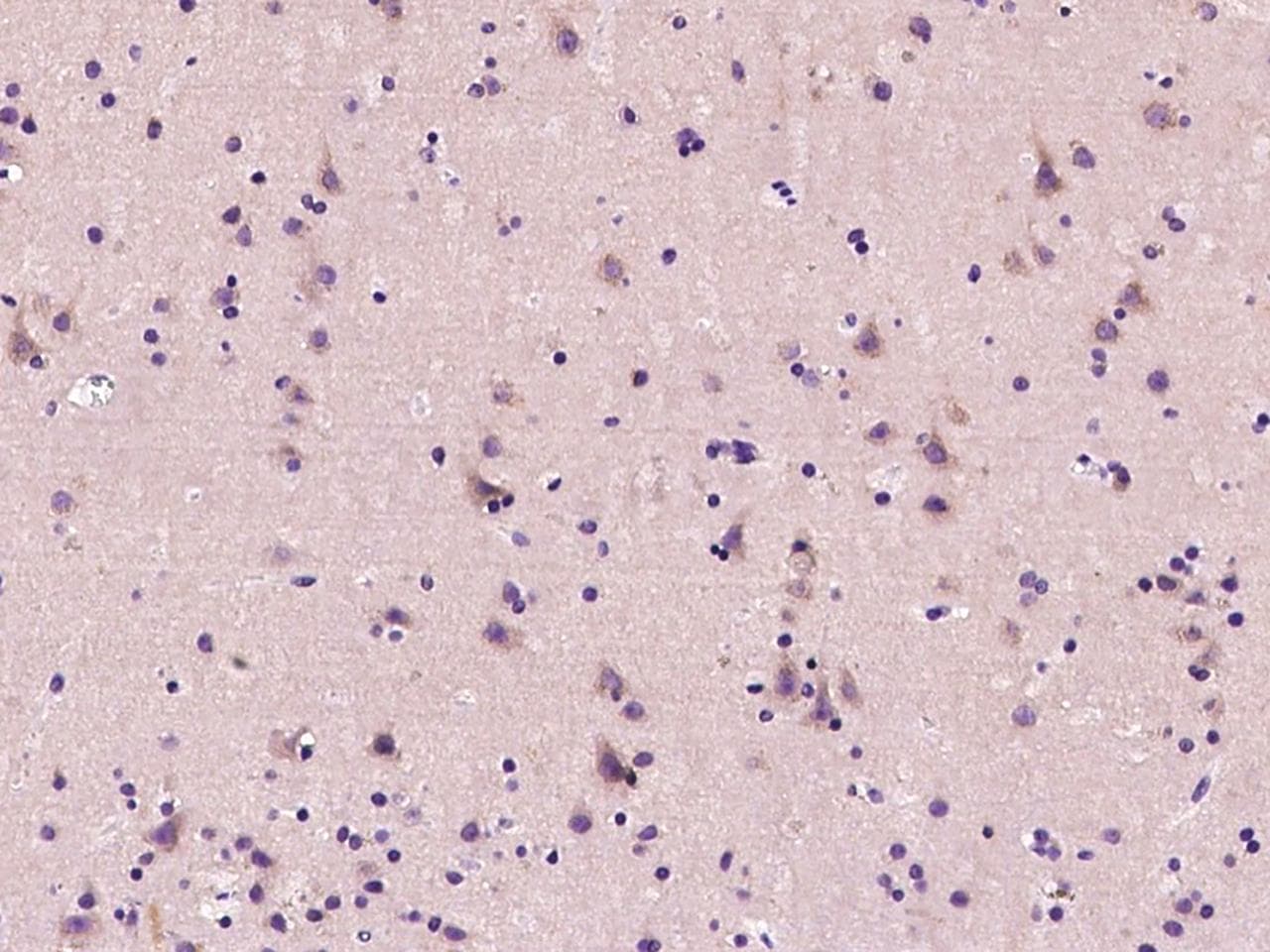 Polyclonal Rabbit anti-Mouse PPP3R1 / Calcineurin B Antibody (IHC)