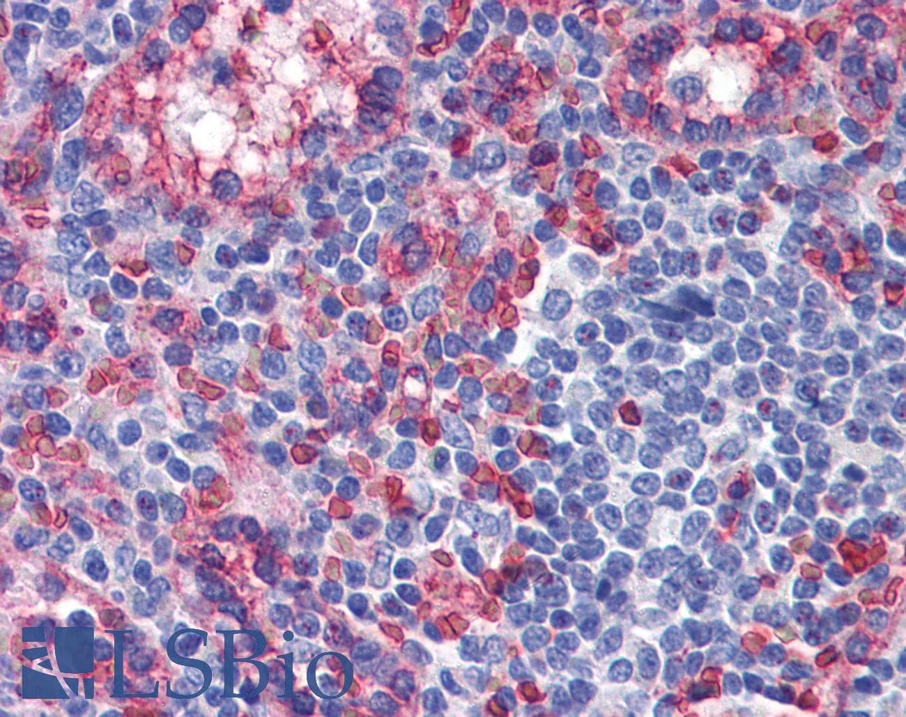 TXNIP Antibody (C-Terminus)