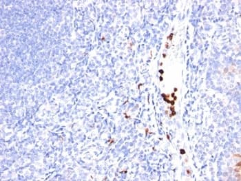 MYADM / Myeloid Marker BM-1 Antibody (clone MYADM/971)