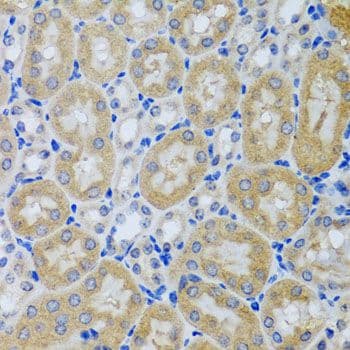 ACP1 / Acid Phosphatase Antibody