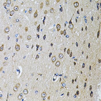 Polyclonal Rabbit anti-Human PTPRE / PTP Epsilon Antibody (IHC, WB)