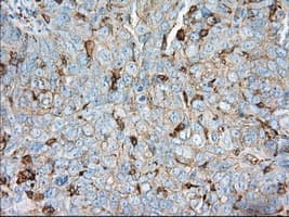 ALDH3A1 Antibody (clone 1B6, Carrier-free)