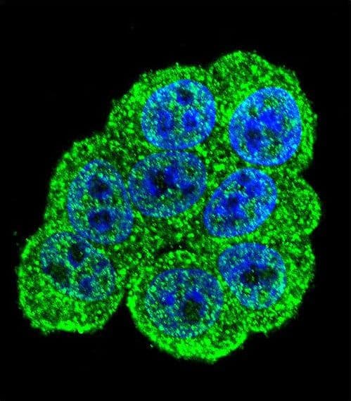 Polyclonal Rabbit anti-Human C1orf107 / DEF Antibody (aa2-30, IHC, IF, WB)