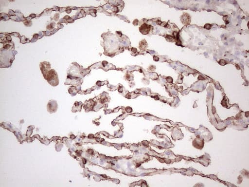 KRT16 / CK16 / Cytokeratin 16 Antibody (clone OTI2H8)