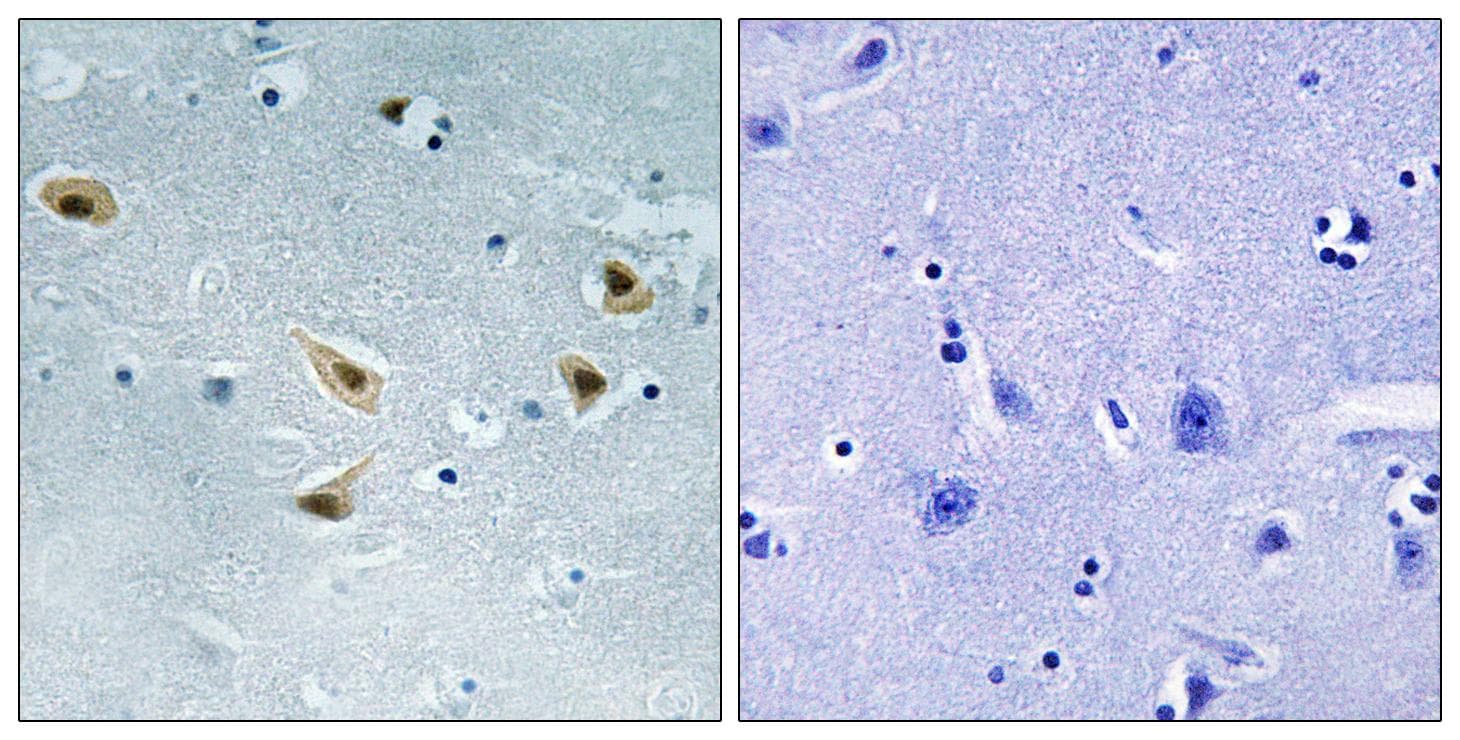 TP53 / p53 Antibody (phospho-Ser376)