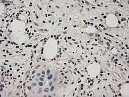 Monoclonal Mouse anti-Human LDHA / LDH1 Antibody (clone OTI2D11, IHC, WB)