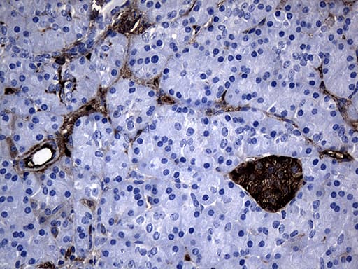 Monoclonal Mouse anti-Human GTPCH1 / GCH1 Antibody (clone OTI7B8, Carrier-free, IHC, WB)