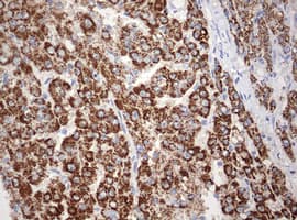 OTC Antibody (aa33-354, clone OTI4G4)