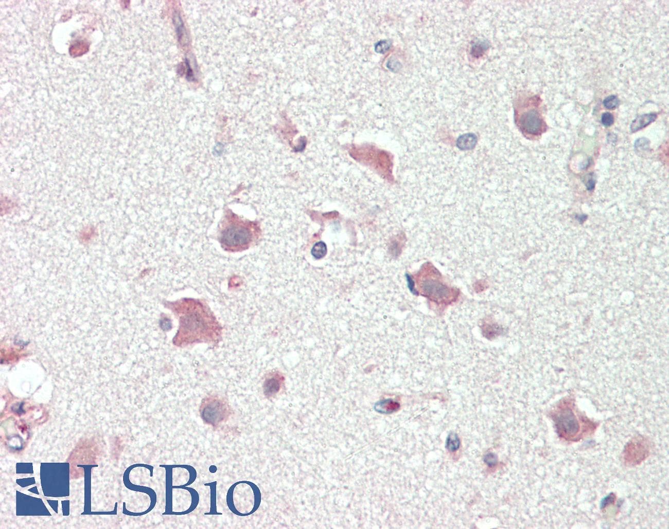 IHC-plus™ Polyclonal Rabbit anti-Human Acetyl-CoA Carboxylase / ACC Antibody (aa2333-C-term, IHC, WB)
