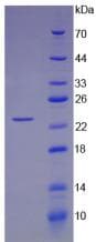 Mouse ANGPT1 / Angiopoietin-1 Protein (Recombinant His)