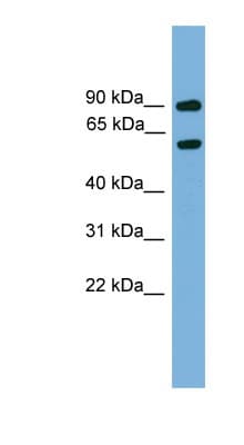 Polyclonal Rabbit anti-Mouse NAB2 Antibody (aa401-450, WB)