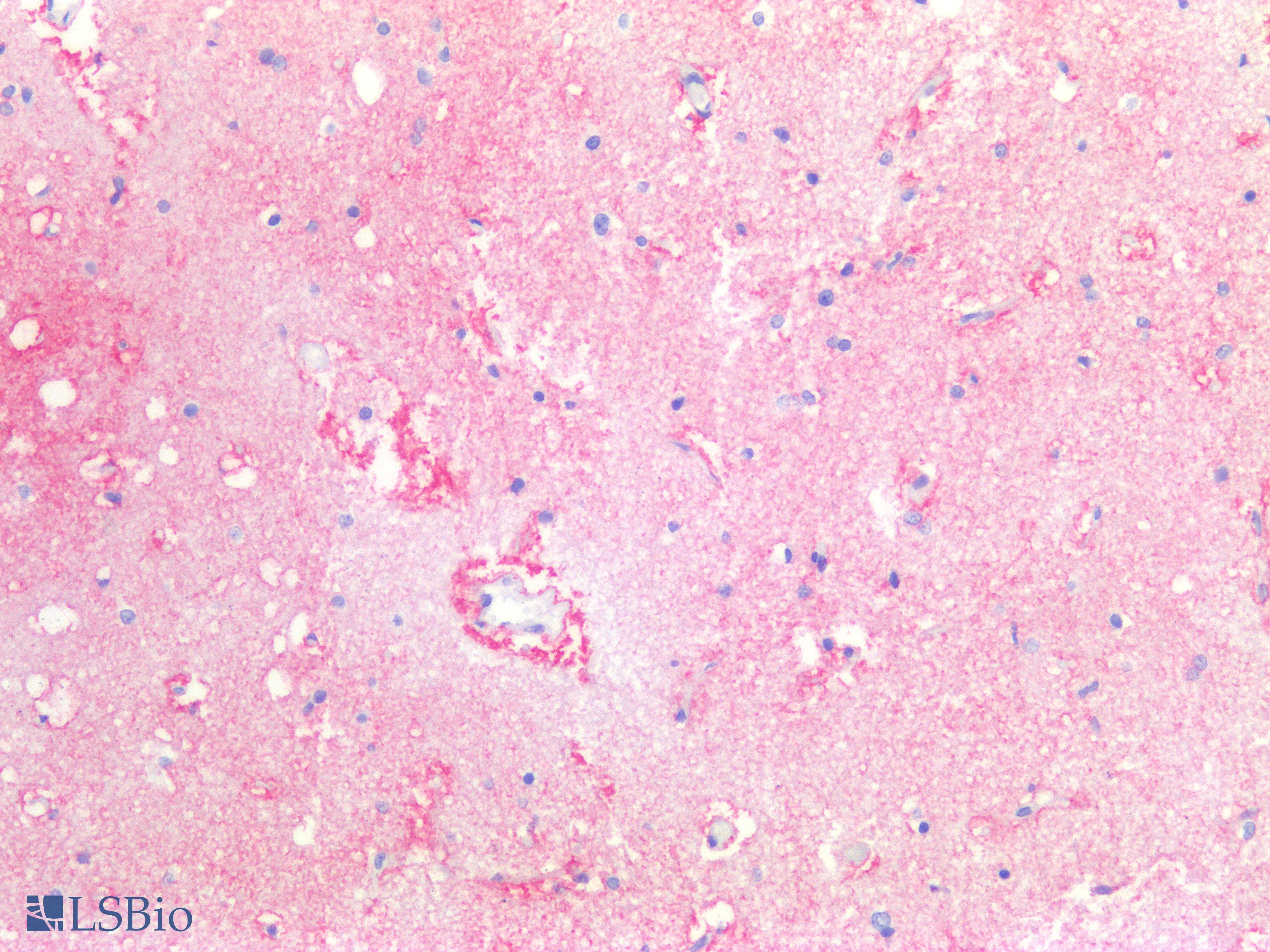 IHC-plus™ F3 / CD142 / Tissue factor Antibody (clone HTF-1)