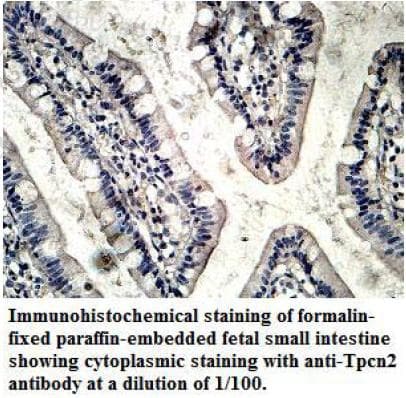 TPC2 / TPCN2 Antibody (N-Terminus)