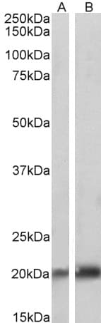 IHC-plus™ Polyclonal Goat anti-Human CAV3 / Caveolin 3 Antibody (aa5-18, IHC, WB)