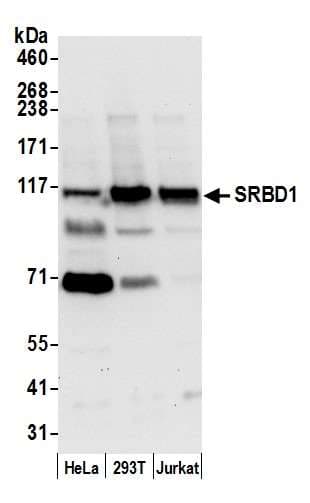 SRBD1 Antibody (aa25-75)