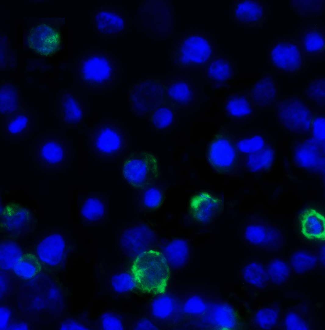 Monoclonal Mouse anti-Human TIGIT Antibody (clone 10B1, IHC, IF)