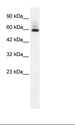 PathPlus™ Polyclonal Rabbit anti-Human PAX7 Antibody (aa167-216, IHC, WB)