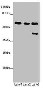 Polyclonal Rabbit anti-Human PRPF4 Antibody (IHC, WB)