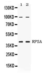 RPSA / Laminin Receptor Antibody