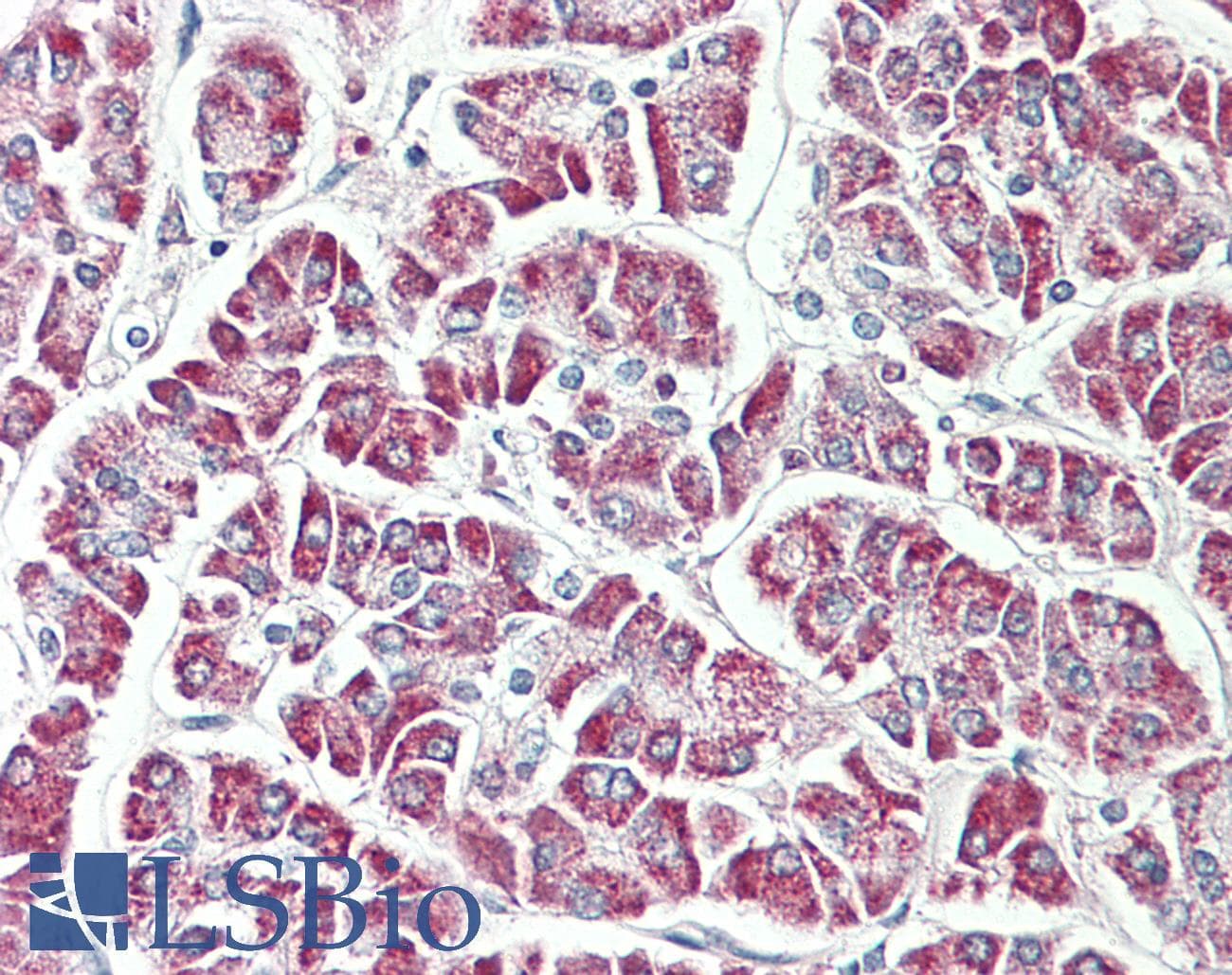 RPL17 / Ribosomal Protein L17 Antibody (Biotin)