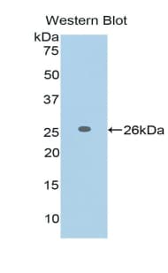 FASLG / Fas Ligand Antibody (aa102-280)