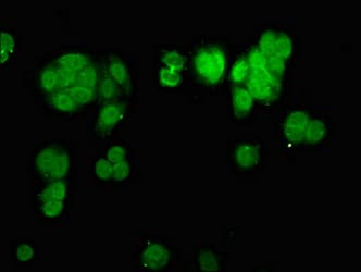 Polyclonal Rabbit anti-Human CHD1L Antibody (IF, WB)