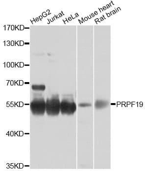 PRPF19 / PRP19 Antibody