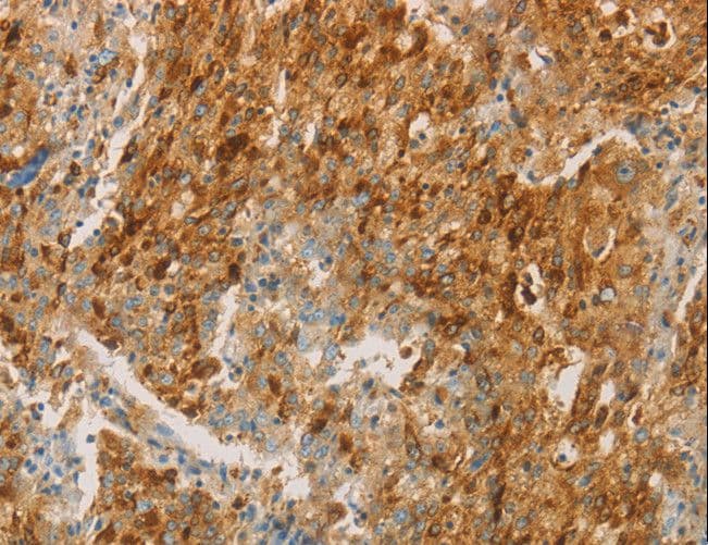 IHC-plus™ CEACAM8 / CD66b Antibody