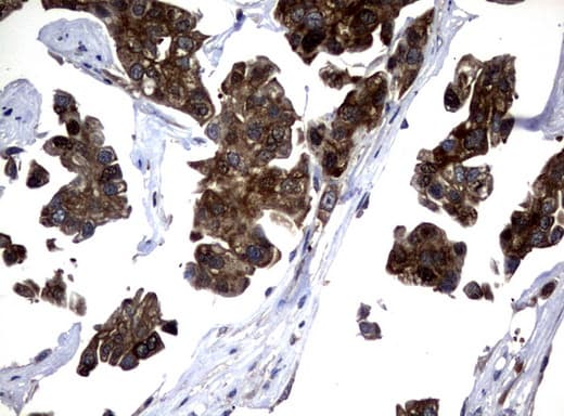 Monoclonal Mouse anti-Human NME1 / NM23 Antibody (clone UMAB93, IHC, IF, WB)