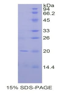 Human CD247 / CD3 Zeta Protein (Recombinant His, N-Terminal)