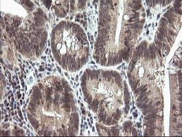 Monoclonal Mouse anti-Human MAP2K3 / MEK3 / MKK3 Antibody (clone OTI5B2, IHC, IF, WB)