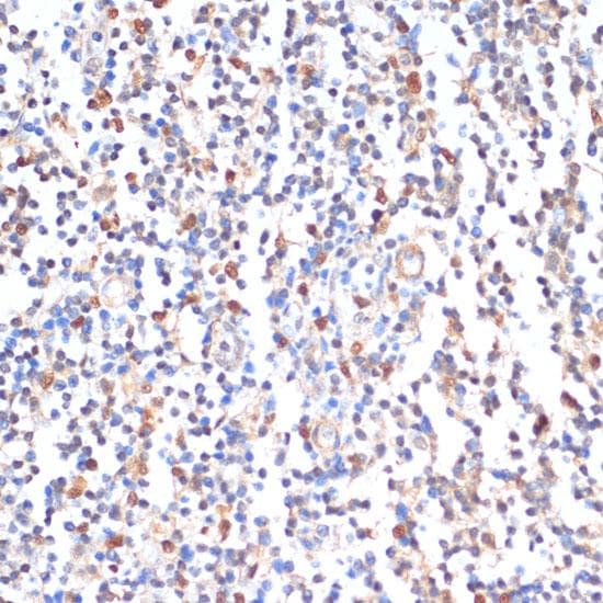 ZMYM3 Antibody
