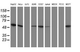 UQCRC1 Antibody (aa46-305, clone OTI1A3)