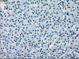 Monoclonal Mouse anti-Human BUB1B / BubR1 Antibody (clone OTI6E5, IHC, IF, WB)