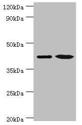 IHC-plus™ ERGIC2 Antibody (aa55-310)