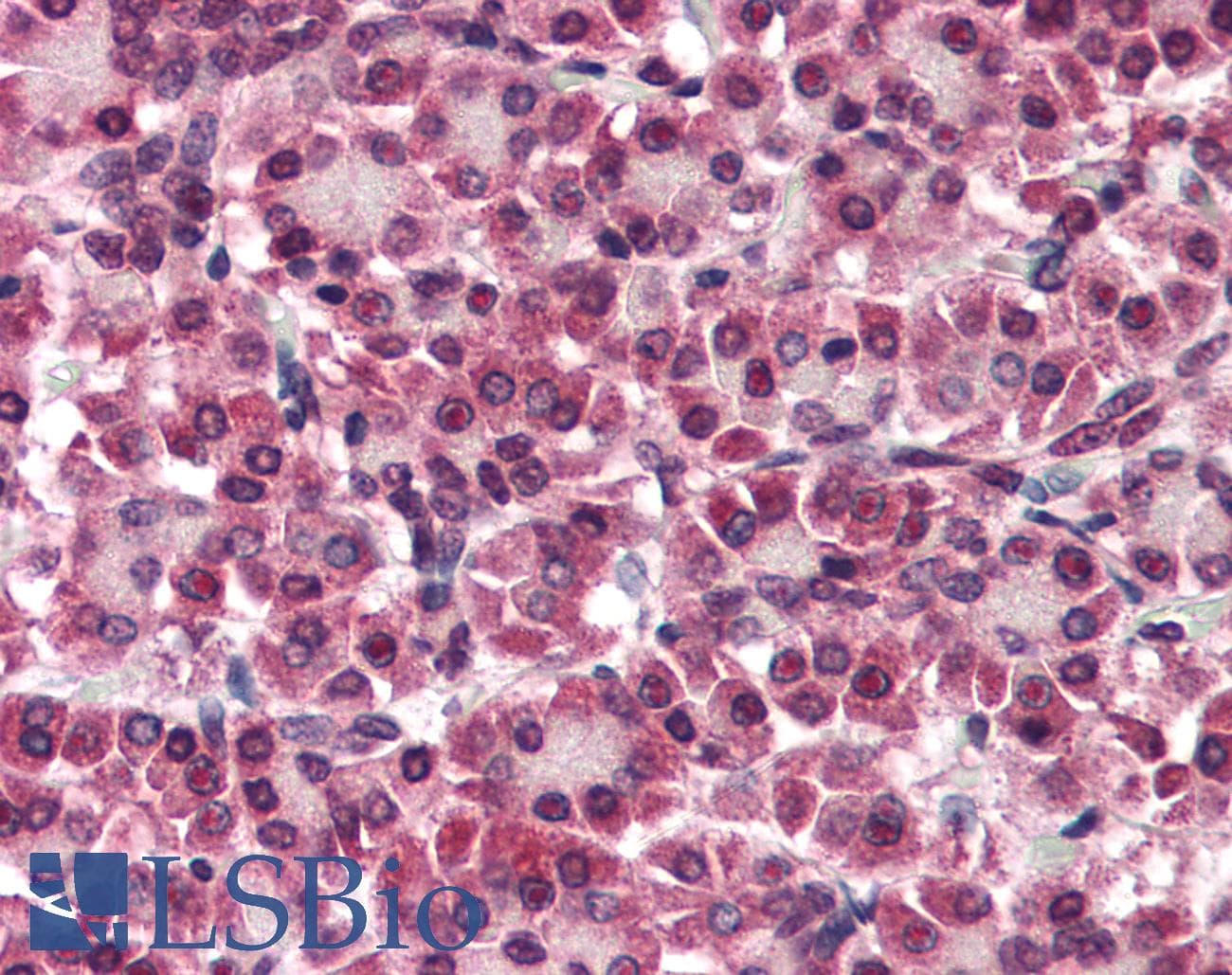 IHC-plus™ Polyclonal Rabbit anti-Human GPC4 / Glypican 4 Antibody (Internal)