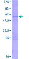 Human FEV / PET1 Protein (Recombinant GST)