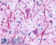 PathPlus™ P2RY8 / P2Y8 Antibody (C-Terminus)
